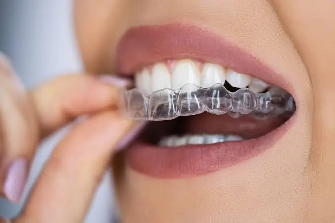 Which Clear Aligner Is Right for You