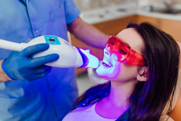 Teeth-Whitening-St-Paul